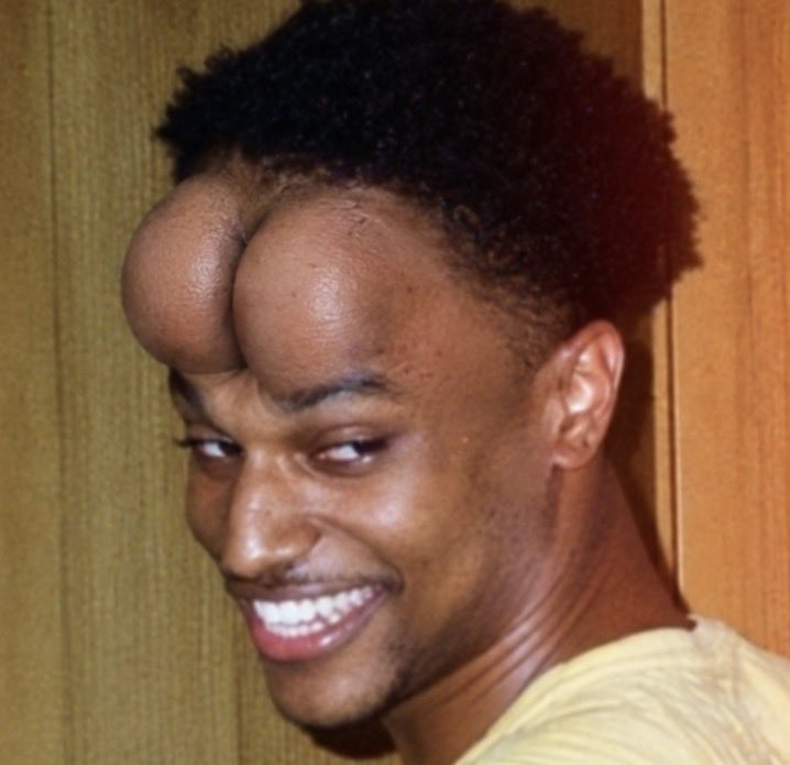 A smiling person with a digitally altered split forehead.