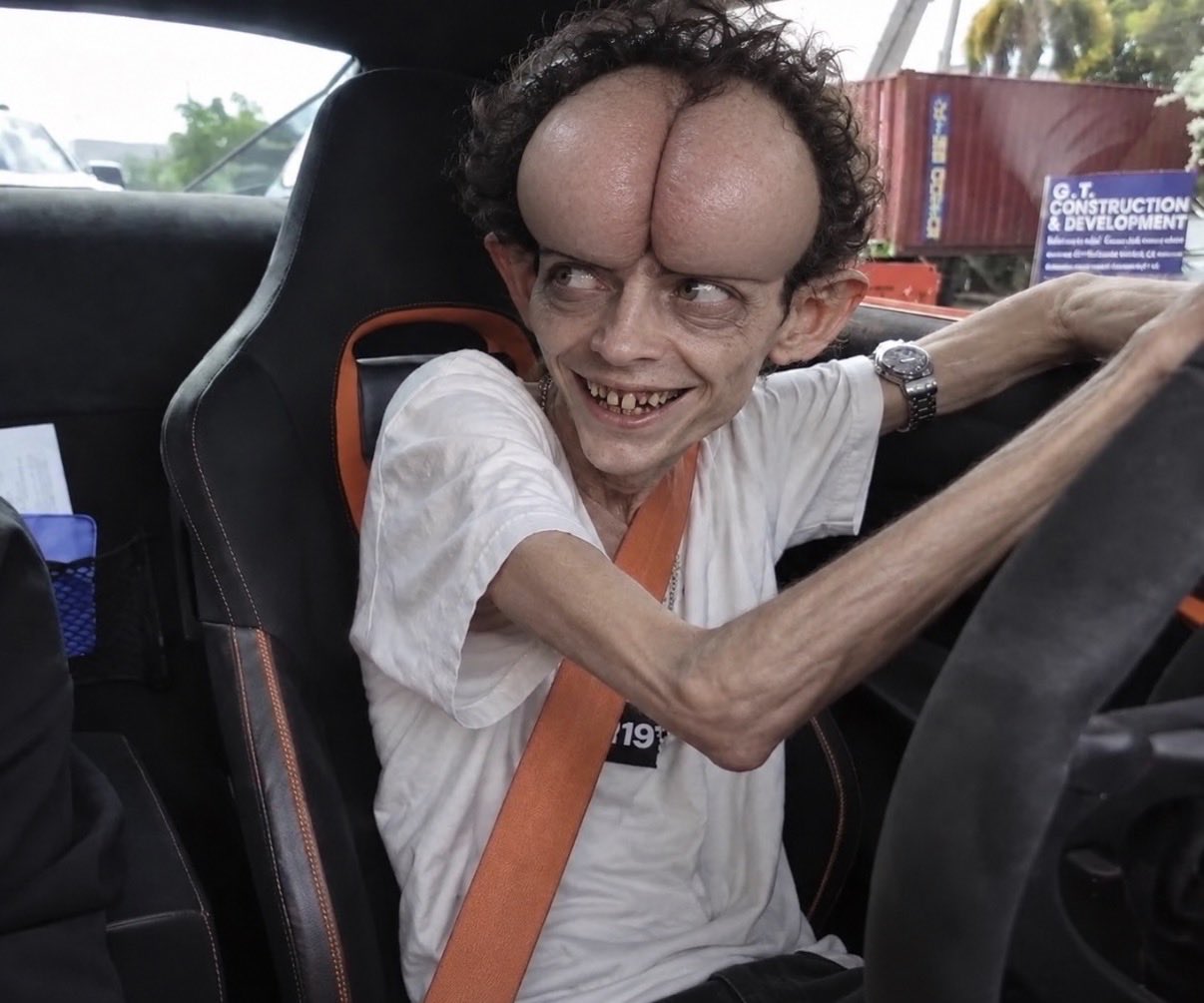 A seated character with a dramatically enlarged split forehead.